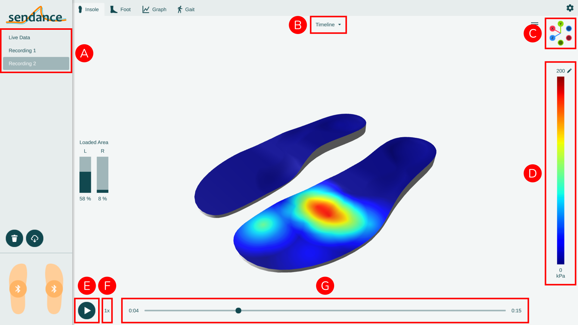 Insole view